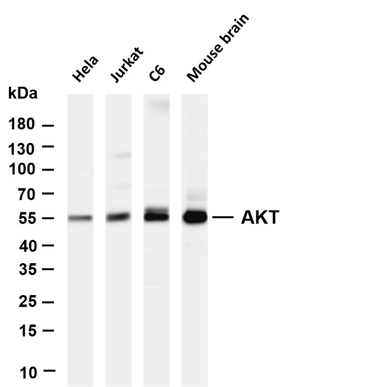 Akt (pan) (PT0654R) PT  Rabbit mAb 